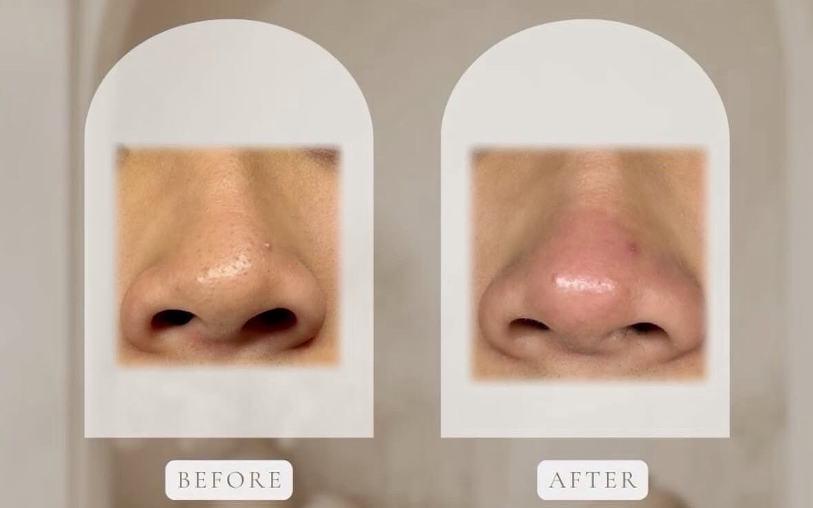 LINE_ALBUM_仙女肌_250828_2