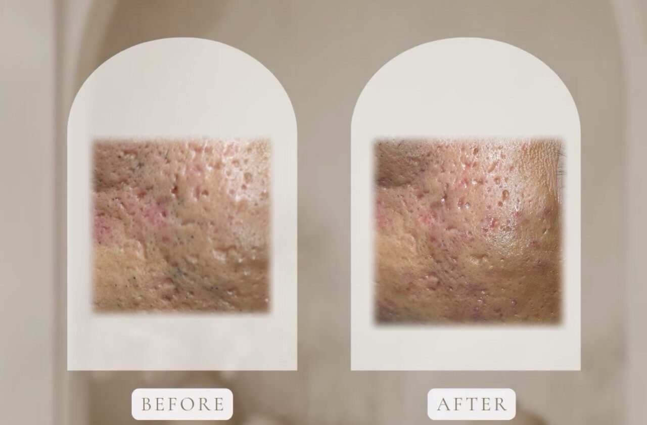 LINE_ALBUM_仙女肌_250828_3