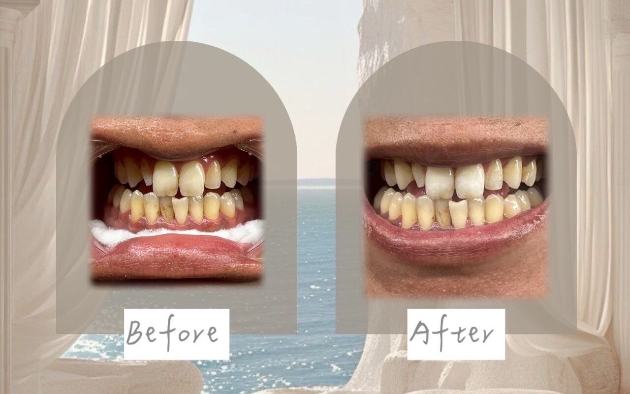 LINE_ALBUM_笑容天使對比_250828_1